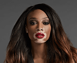 Winnie Harlow - Professional null Speaker