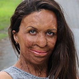 Turia Pitt - Professional null Speaker