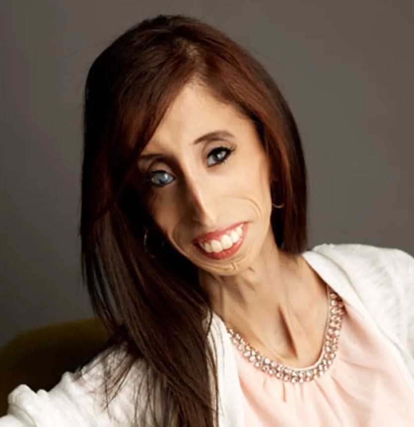 Lizzie Velasquez - Professional null Speaker