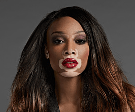 Winnie Harlow - Professional null Speaker